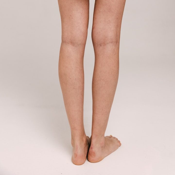 alt="Smooth legs after laser hair removal treatment in Newcastle"