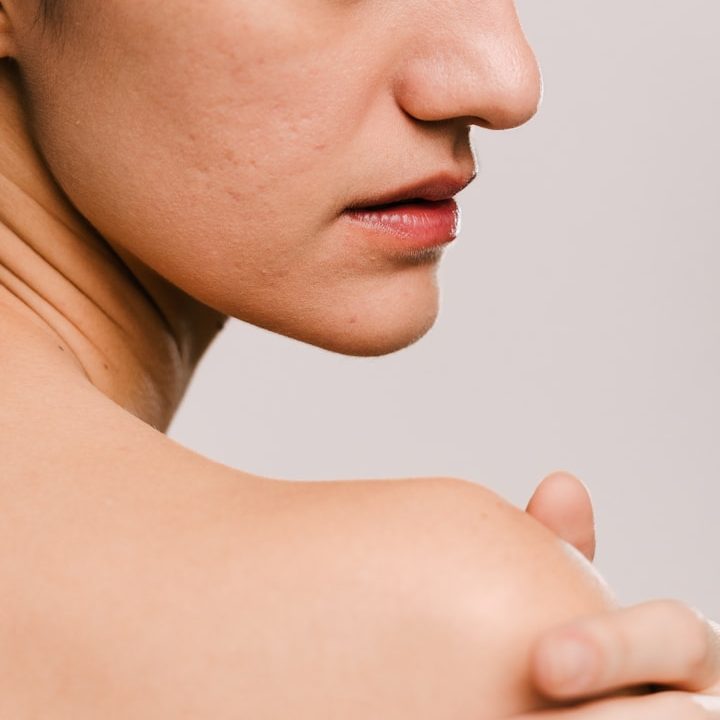 alt="laser hair removal treatment for chin and upper lip and full face in Newcastle"