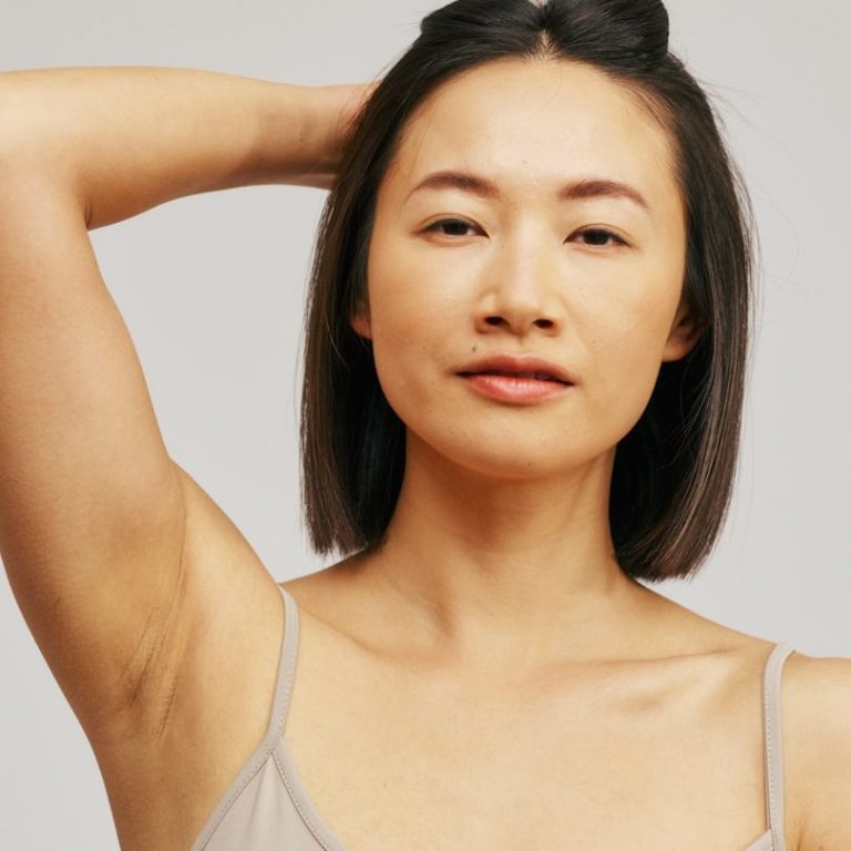 alt="woman showing underarm before laser hair removal treatment in Newcastle"